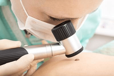 Mole Evaluation