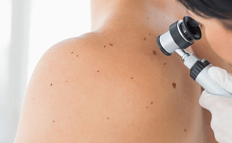 Skin Screening