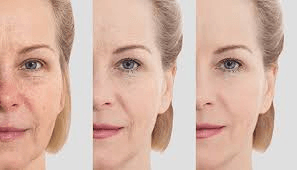 Preventive Aging