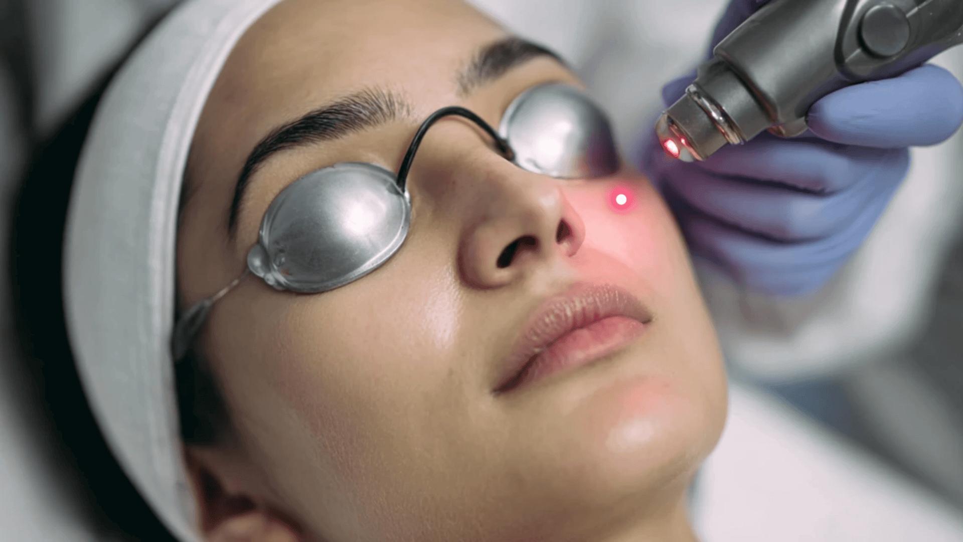 Pigment Laser