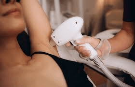 Hair Removal Laser