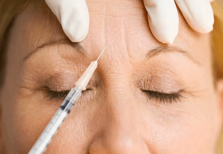 Botox Treatment