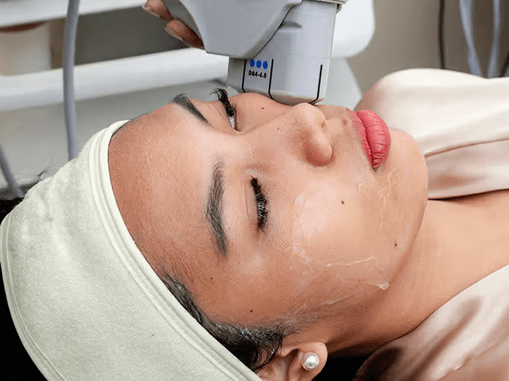 HIFU Treatment