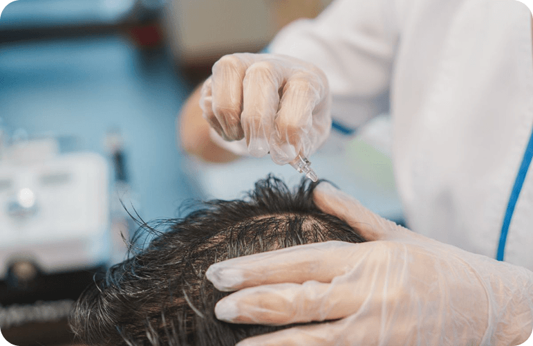 Hair Regrowth Programs