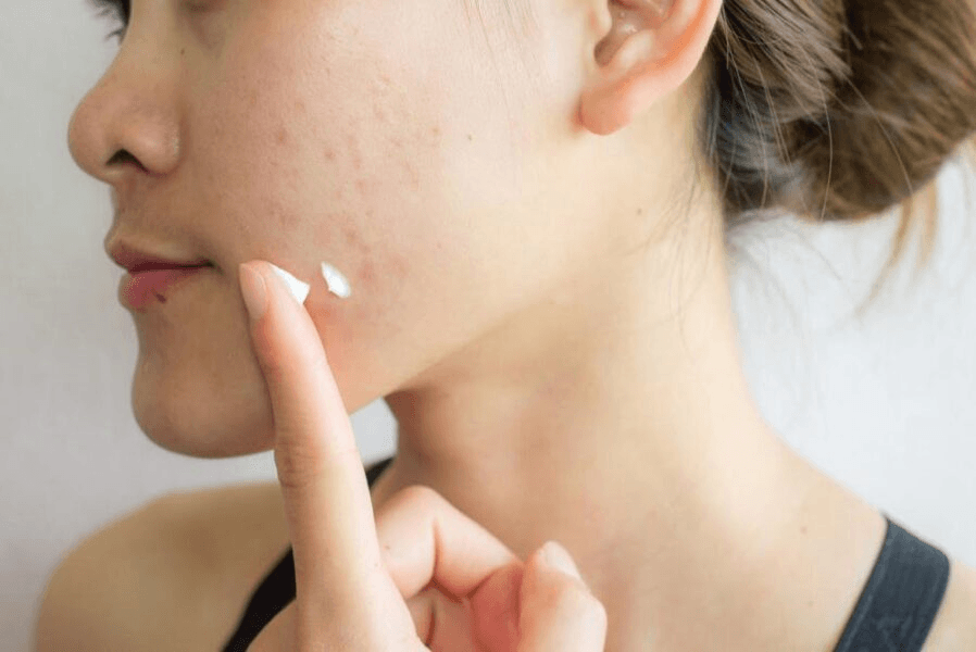 Scar Treatments