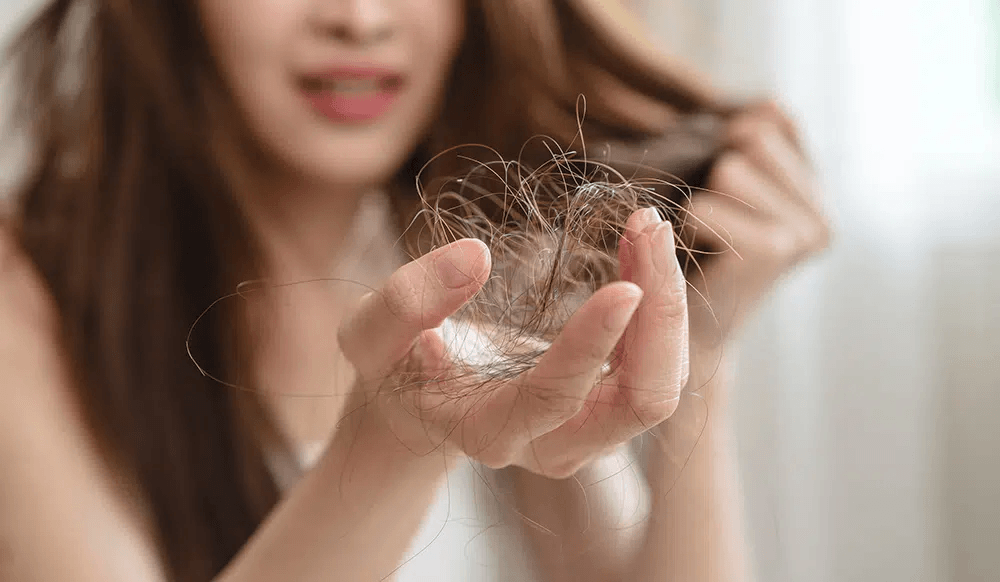 Hair Loss in Women