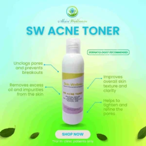SW ACNE TONER
